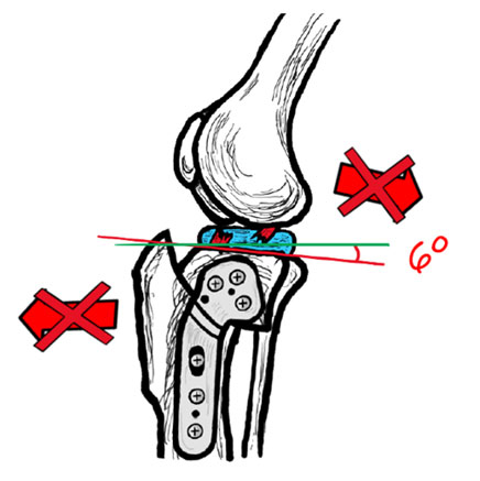 Image of a canine knee joint after TPLO surgery - Image copyright of Rebecca Jones
