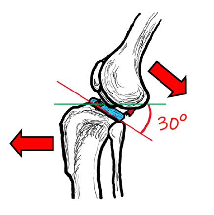 Image of a canine knee joint with a torn cranial cruciate ligament. - Image copyright of Rebecca Jones