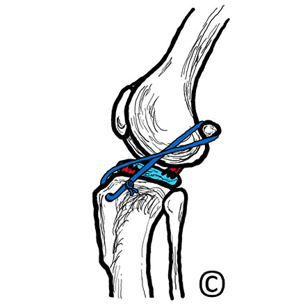Image of a canine knee joint after ELSS surgery - Image copyright of Rebecca Jones